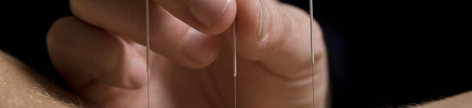 Needles pic